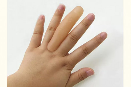 Sexto dedo Normal (blando)