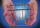 Cage à Disparition à vue