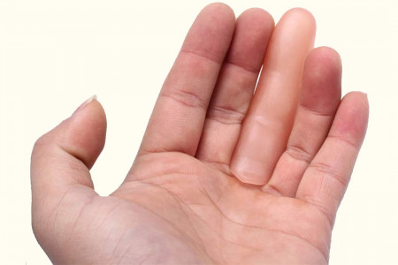 Sexto dedo Normal