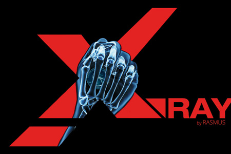 X Ray - rasmus X Ray - rasmus