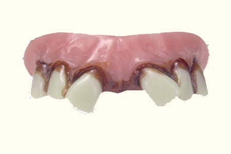 Dentadura postiza - Paletos separados