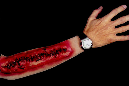Manche Gore - Blessure recousue