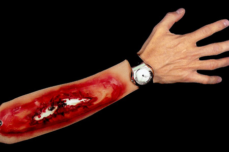 Manche Gore - Os cassé